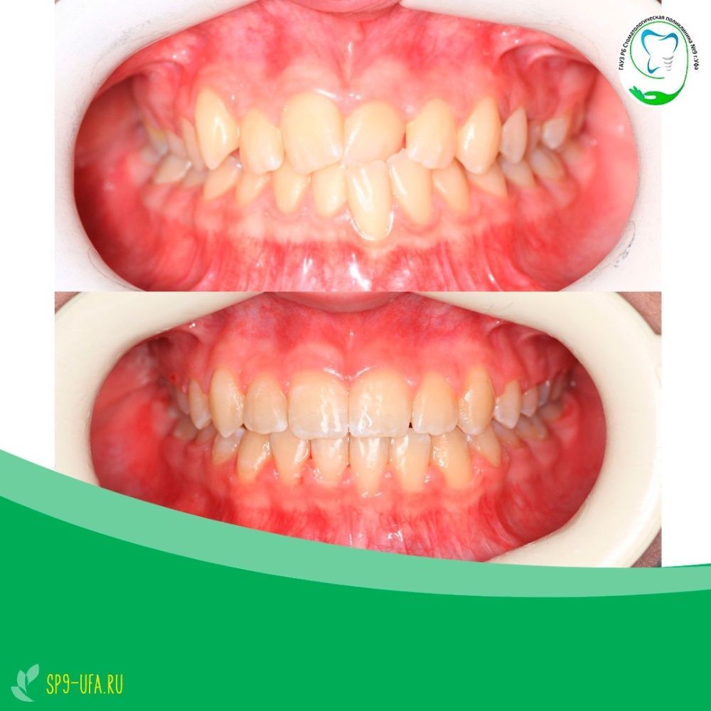 Клинический случай